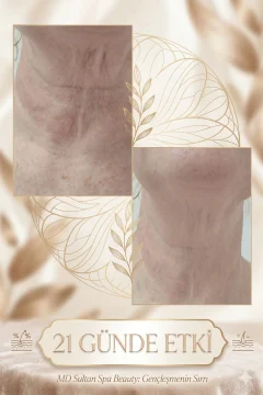 MD Sultan Spa Beauty Cilt Sıkılaştırıcı Düzeltici Doğal Yağ Neck Firming Oil 30 ml 4